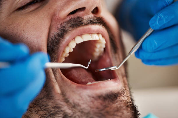 Best Emergency Cosmetic Dentistry (e.g., broken veneers) in Winnsboro, TX